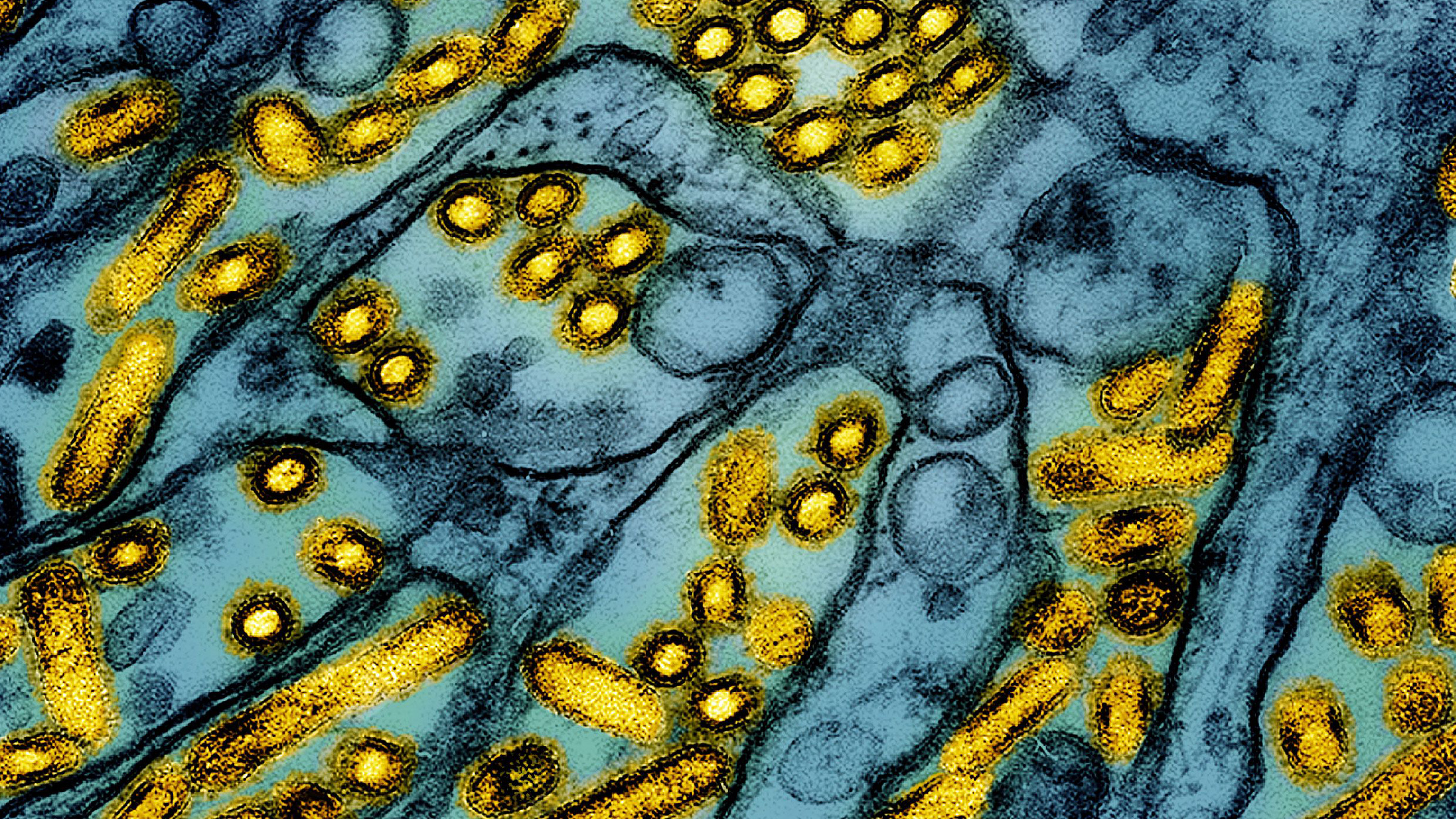 A genetic analysis of samples of the bird flu virus from a Louisiana patient show the virus likely mutated in the patient to potentially become more transmissible to humans.